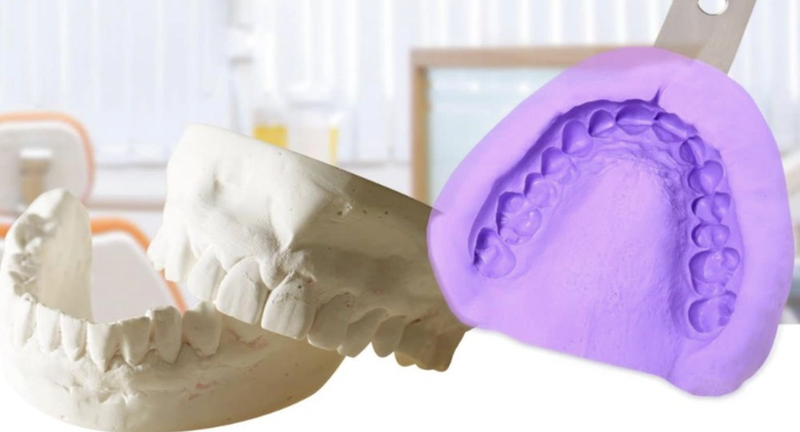 cau-rang-su-mot-giai-phap-nha-khoa-hieu-qua 3