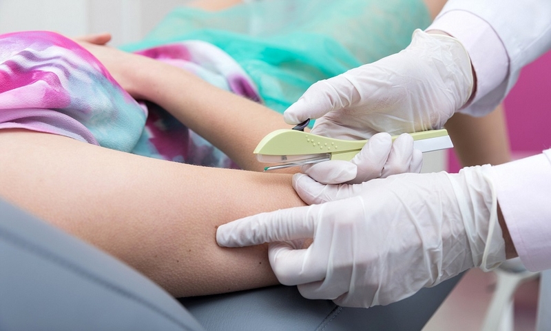 Cấy que tránh thai có mất sữa không và nên cấy que tránh thai vào thời điểm nào? 4