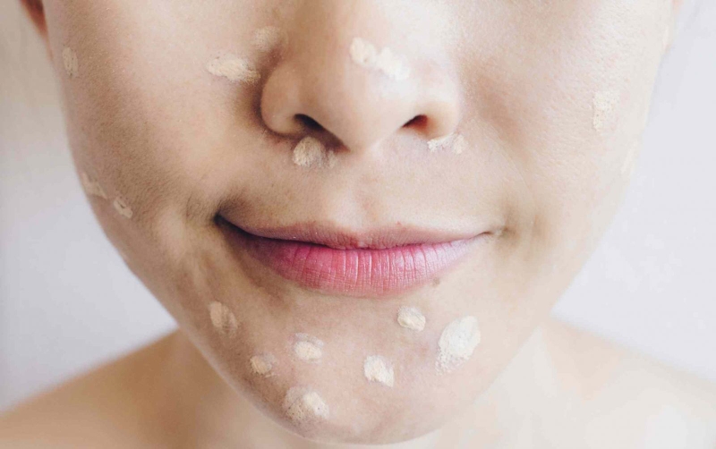 Chăm sóc da đúng cách là nên bôi kem trị mụn trước hay sau kem dưỡng 2