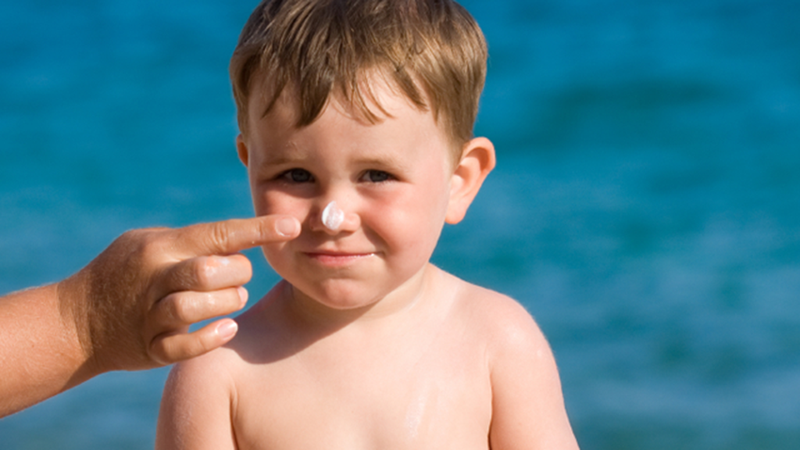 Cháy nắng ở trẻ em - Nguyên nhân và cách xử trí 2