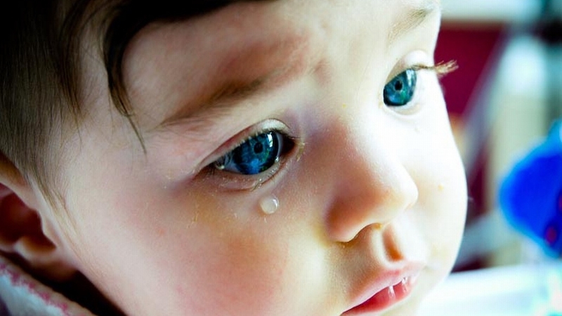 nhung-dieu-can-biet-ve-benh-ly-cuom-nuoc-o-tre-em-2