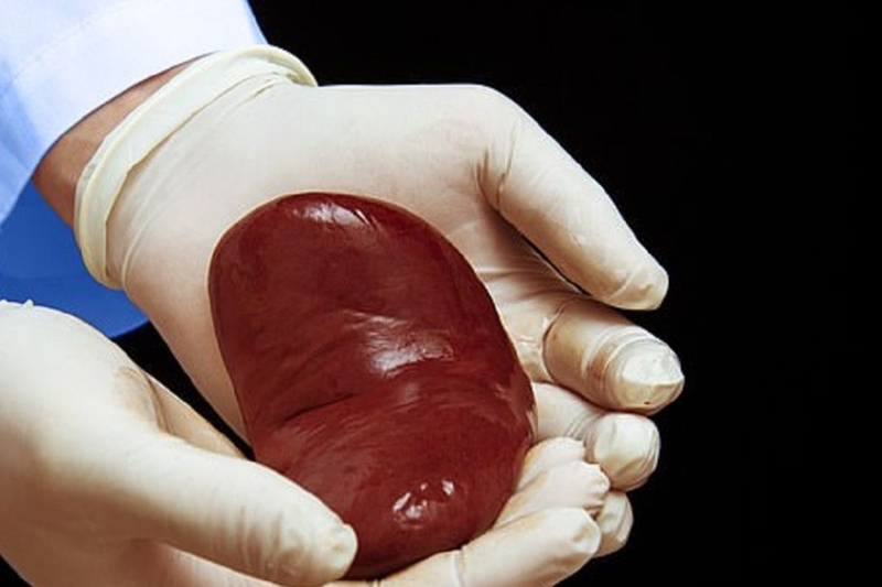 Chạy thận và ghép thận là gì? Nên lựa chọn chạy thận hay ghép thận khi điều trị 2