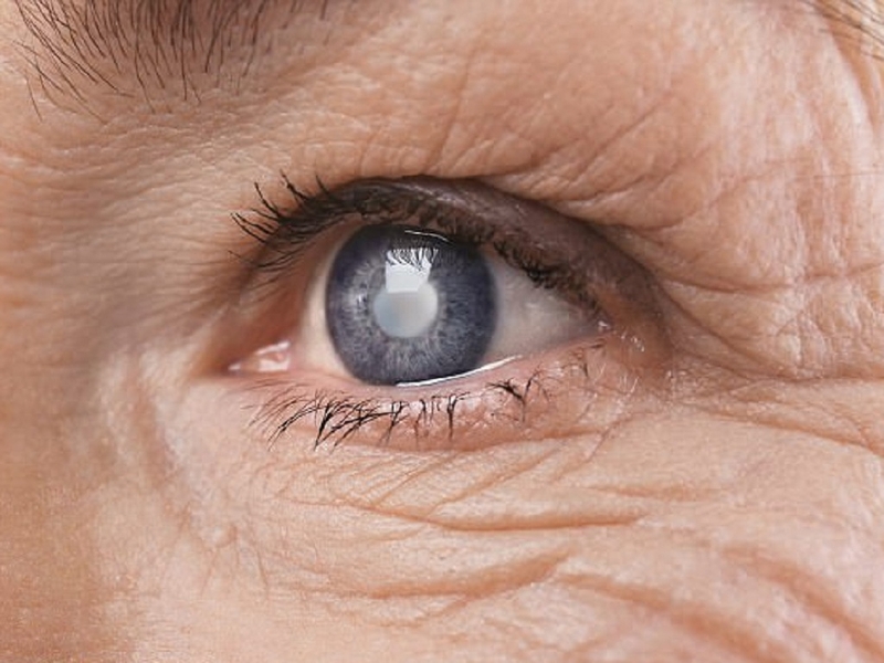 Có nên mổ mắt cho người bị tiểu đường