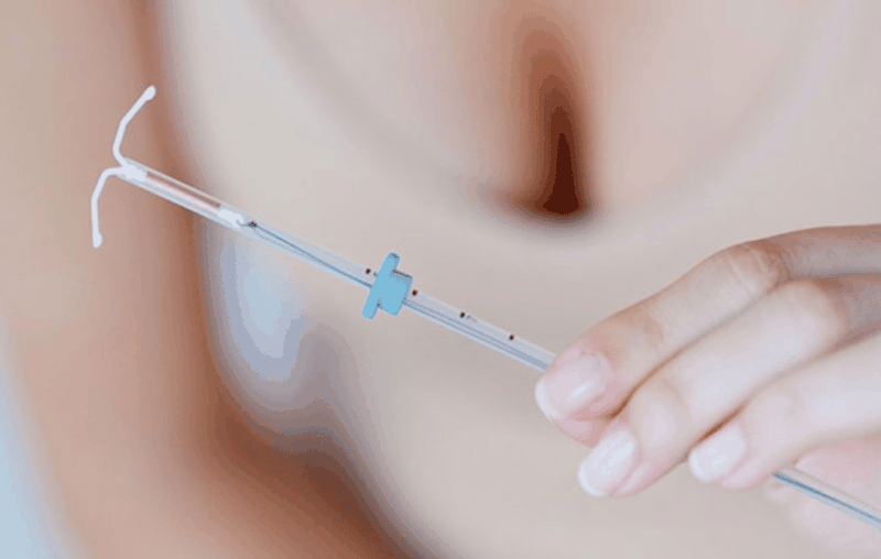 Chi-phi-dat-vong-tranh-thai 2.png