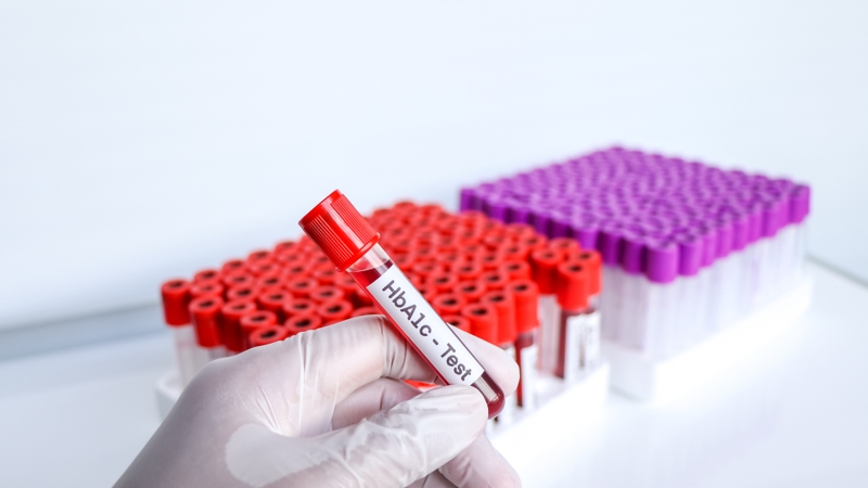 Chỉ số đường huyết của trẻ em_ Những điều mẹ cần biết để bảo vệ sức khỏe con-2.jpg