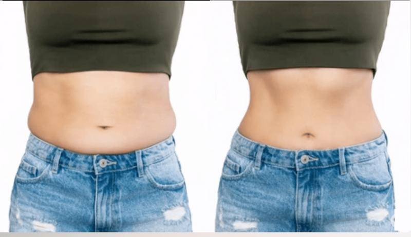 Chia sẻ các bài tập giảm mỡ bụng dưới giúp chị em tự tin hơn về vóc dáng 3