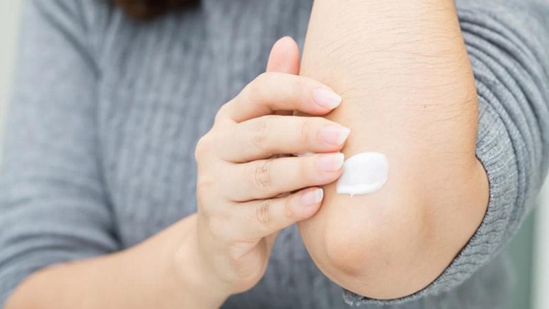 Chia sẻ thông tin 2 nhóm thuốc trị chốc lở ở trẻ em hiệu quả  2