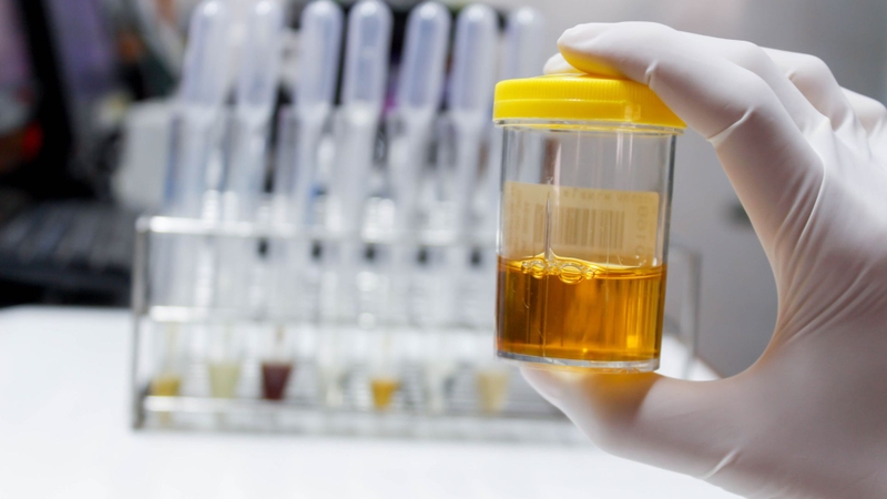 Cilastatin phần lớn được thải trừ qua nước tiểu