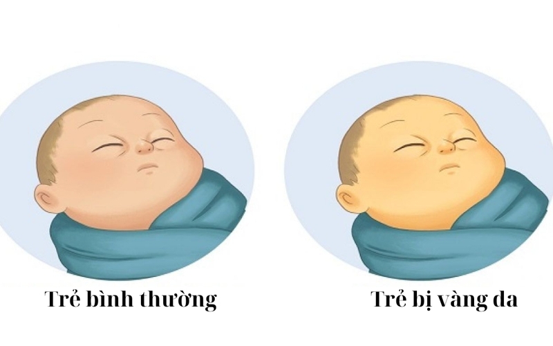 Cỏ mần trầu là cây gì? Dùng cỏ mần trầu tắm cho trẻ có tốt không? 3