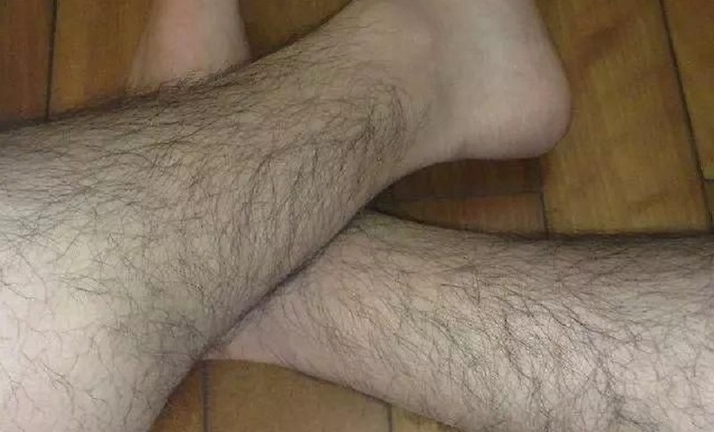 Có nên triệt lông chân và cách triệt lông nào hiệu quả nhất? 1