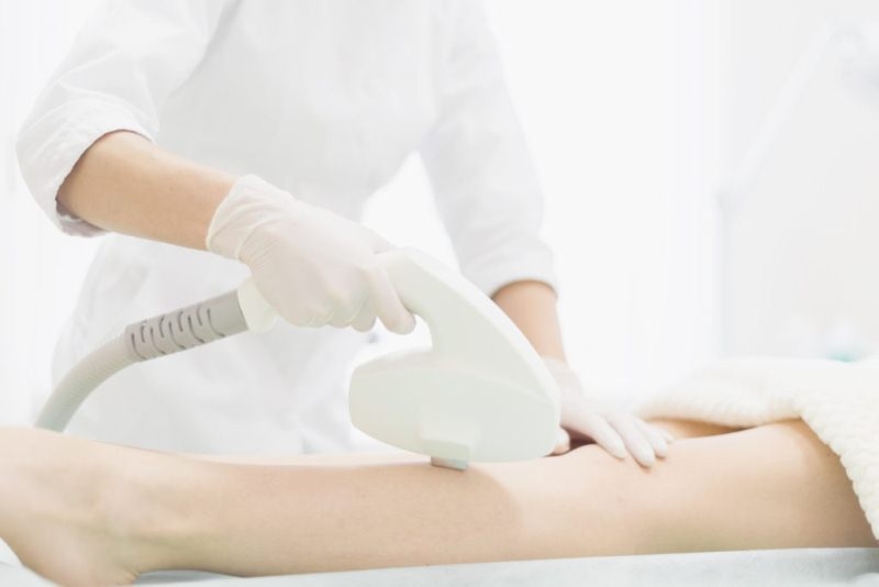 Có nên triệt lông chân và cách triệt lông nào hiệu quả nhất? 4
