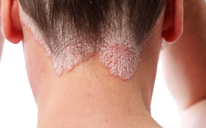 Co-the-dung-gung-tri-vay-nen-duoc-khong (2).png