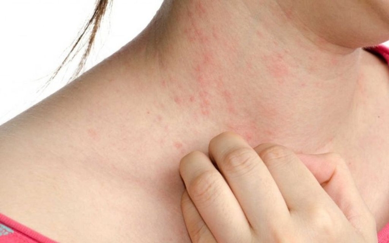 Công thức bạch cầu có ý nghĩa gì với cơ thể? Các chỉ số bạch cầu nên biết 4