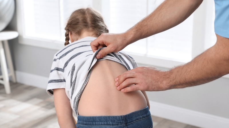 Lưng gù hoặc lệch trục có thể là dấu hiệu cong vẹo cột sống ở trẻ