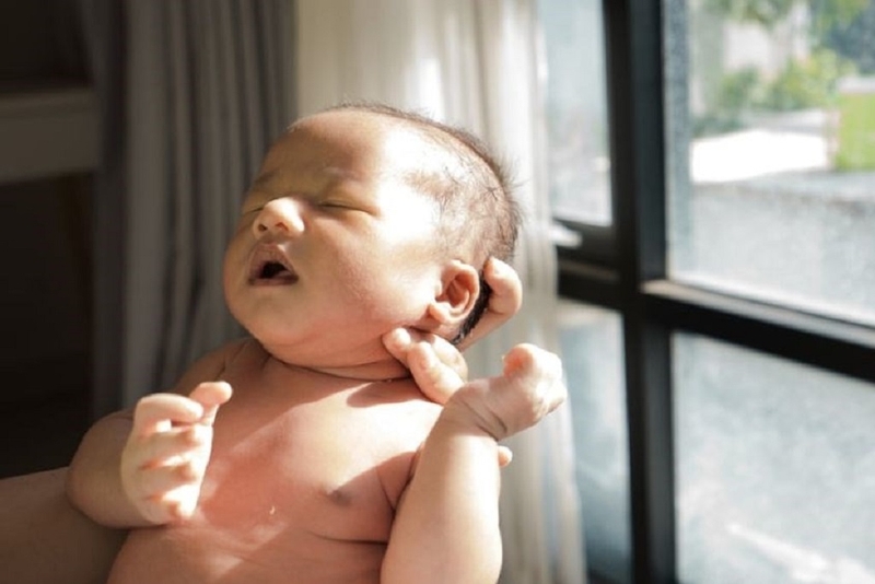 Da trẻ sơ sinh không đều màu có sao không? Nguyên nhân khiến da trẻ sơ sinh không đều màu 4