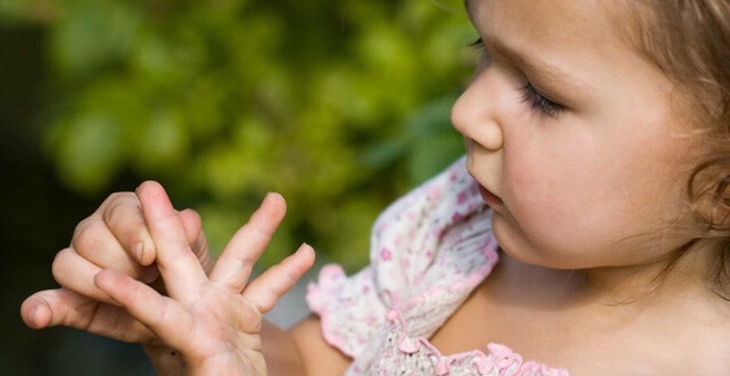 Hướng dẫn cách sơ cứu 5 loại chấn thương hay xảy ra ở trẻ nhỏ 3