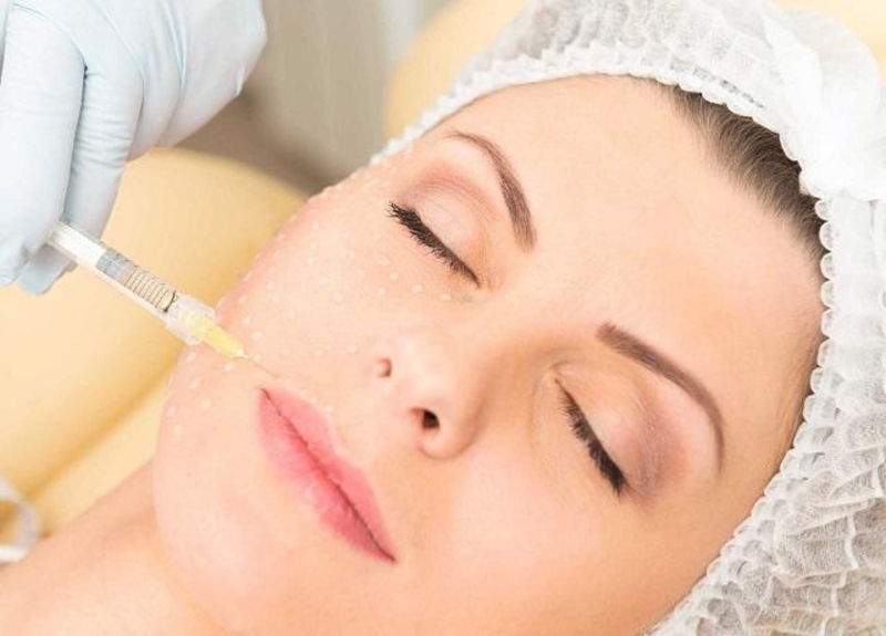 Đang cho con bú tiêm filler có sao không? 2