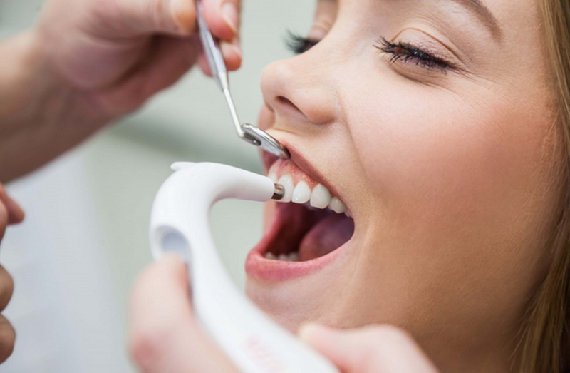 Đánh bóng răng có trắng không? Quy trình đánh bóng răng thế nào 1