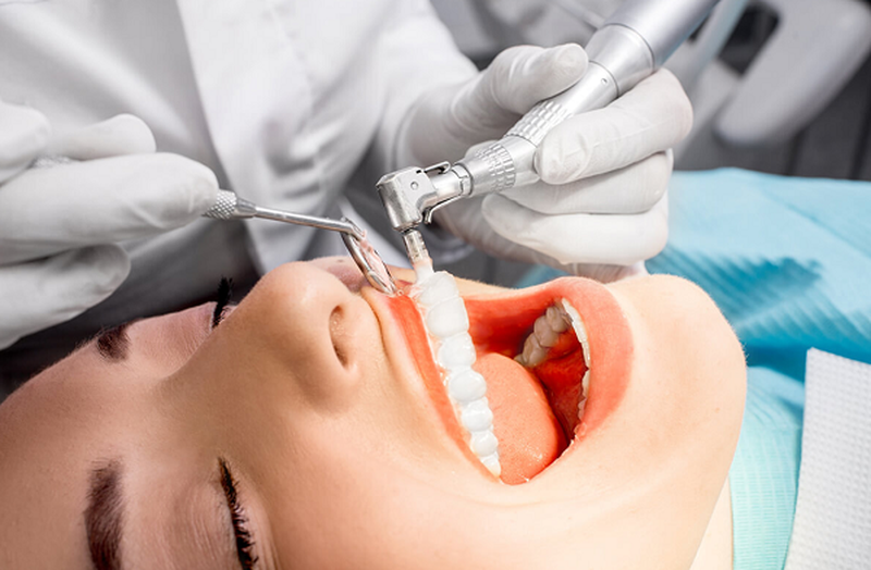 Đánh bóng răng có trắng không? Quy trình đánh bóng răng thế nào 3