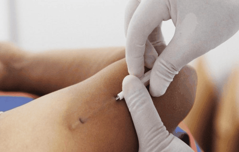 Dat-vong-tranh-thai-o-tay-la-gi 2.png