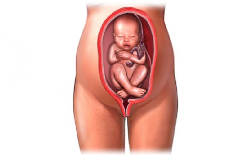 Dấu hiệu chuyển dạ của ngôi thai ngược và những nguy cơ có thể xảy ra 1