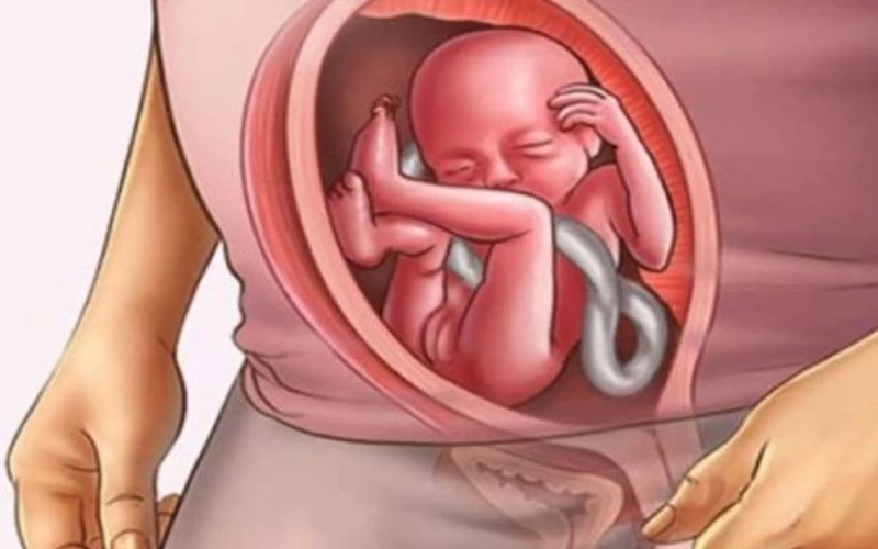 Dấu hiệu chuyển dạ của ngôi thai ngược và những nguy cơ có thể xảy ra 2