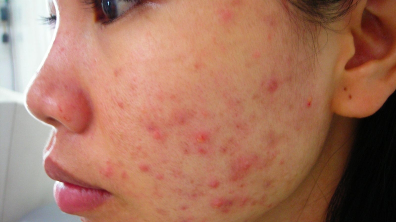 Dấu hiệu nào nhận biết bạn sở hữu da mặt nhạy cảm 3