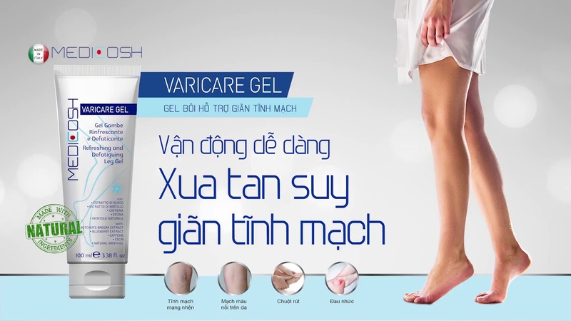 Dấu hiệu nhận biết, phương pháp phòng ngừa và điều trị suy giãn tĩnh mạch chân như thế nào 2