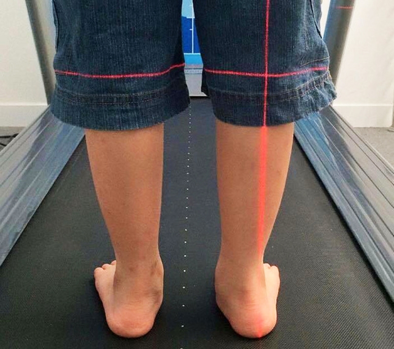 Đau khớp cổ chân ở trẻ em - Cảnh báo viêm khớp mãn tính gây teo cơ, biến dạng xương 2