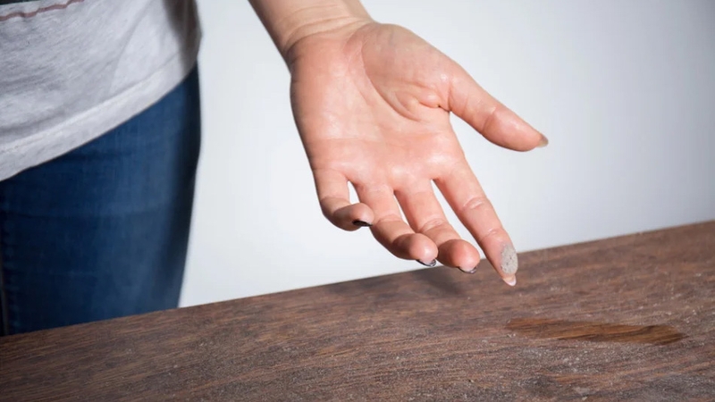 Dị ứng mạt bụi - Nguyên nhân gây ra viêm xoang, hen suyễn 3