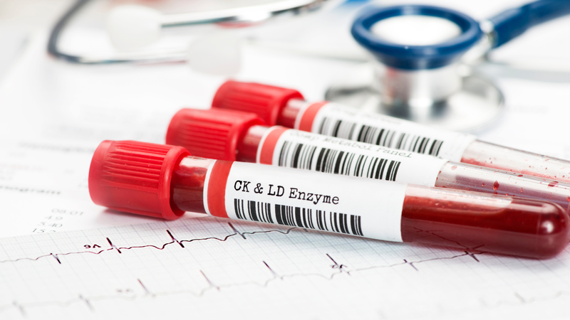 Dịch vụ lấy mẫu máu xét nghiệm tại nhà Hà Nội: Quy trình và những lưu ý khi thực hiện - 2