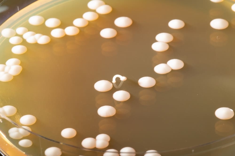 Điều trị nấm miệng ở trẻ 2 tuổi 1