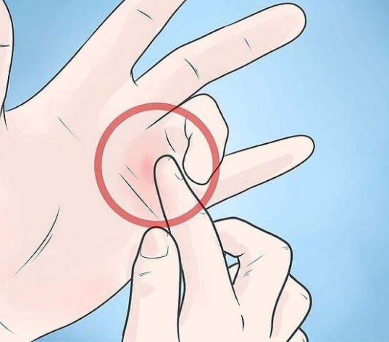 Điều trị và phòng ngừa bệnh ngón tay cò súng 2