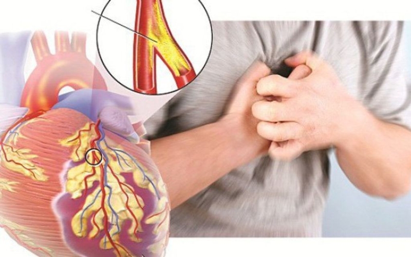Đo độ cứng động mạch là gì? Giá trị và phương pháp đo độ cứng động mạch 2