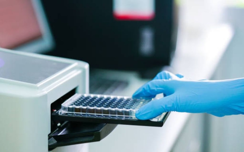 Đo od là gì? Nguyên lý, phương pháp đo và ý nghĩa trong xét nghiệm sinh hoá 1