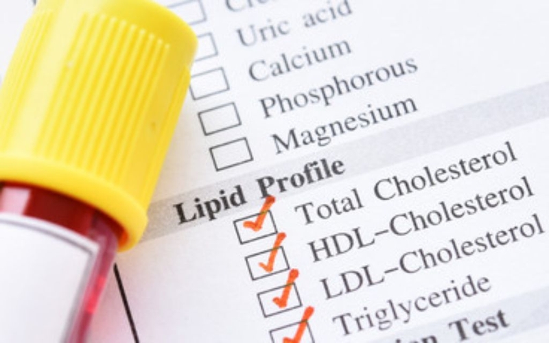 Đo od là gì? Nguyên lý, phương pháp đo và ý nghĩa trong xét nghiệm sinh hoá 3