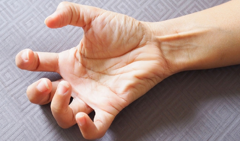 Động kinh là gì? Phân loại các cơn động kinh và điều trị bệnh động kinh 1