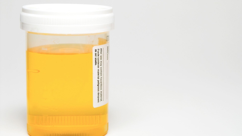 Aniracetam chủ yếu thải trừ qua nước tiểu