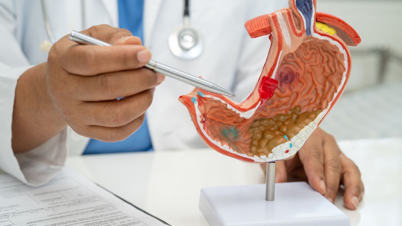 Floctafenine chống chỉ định ở bệnh nhân loét dạ dày - tá tràng