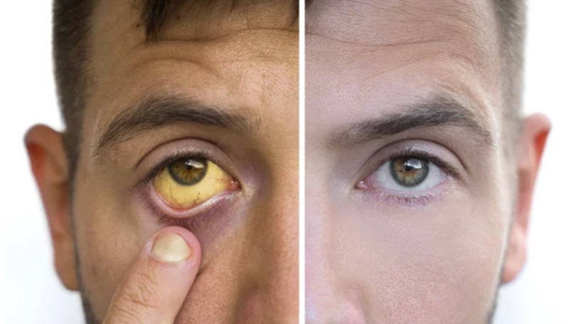 gan-yeu-va-nhung-dieu-can-biet 2