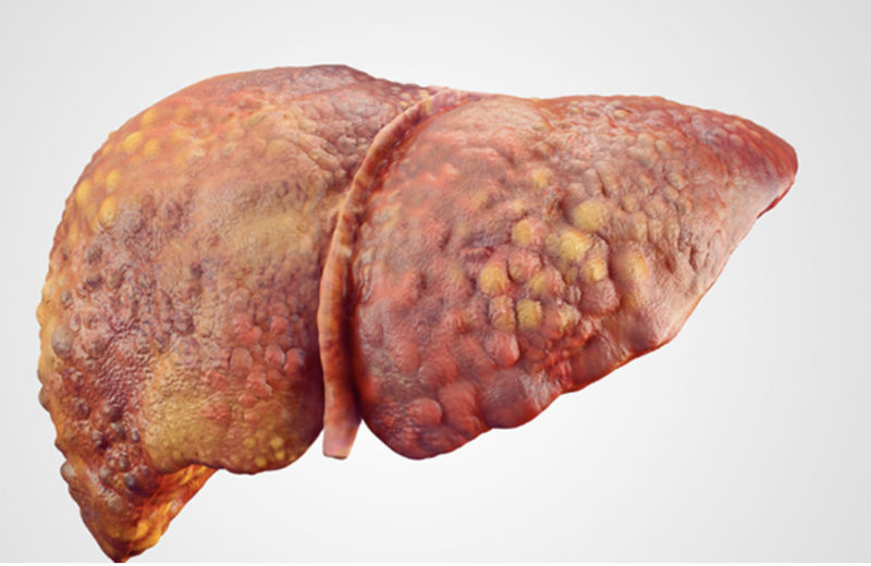 gan-yeu-va-nhung-dieu-can-biet 3