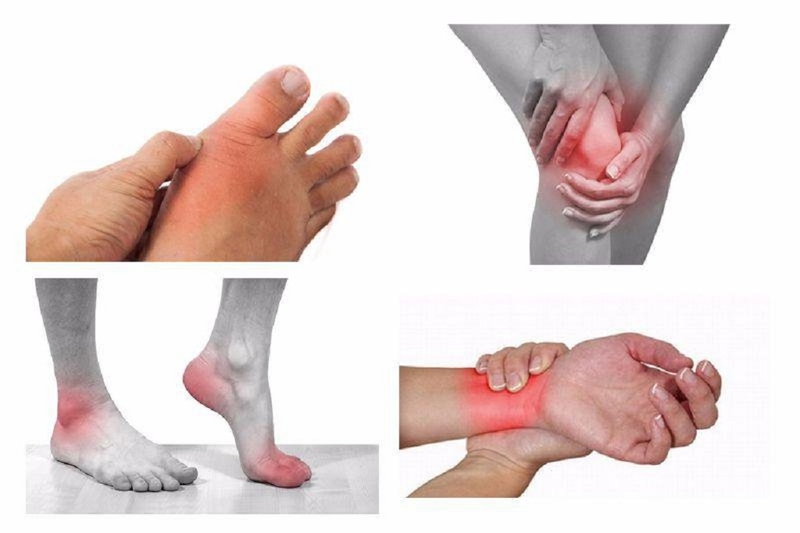 Gãy xương cành tươi: Chấn thương thường thấy ở trẻ nhỏ 3