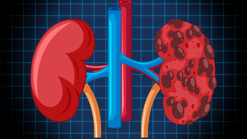 Gentamicin và những điều cần biết 7.png