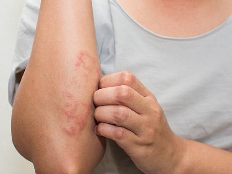 Giải cứu lá gan bằng những cách thải độc gan hiệu quả 1