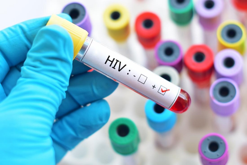 Giải đáp thắc mắc: HIV là gì? Xác suất lây nhiễm HIV từ nữ sang nam là bao nhiêu? 2