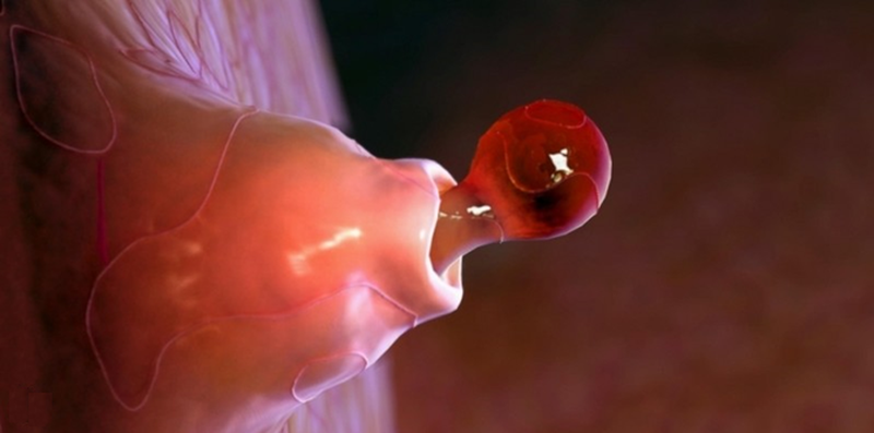 Giải đáp thắc mắc Trứng rụng bao lâu thì phóng noãn 1