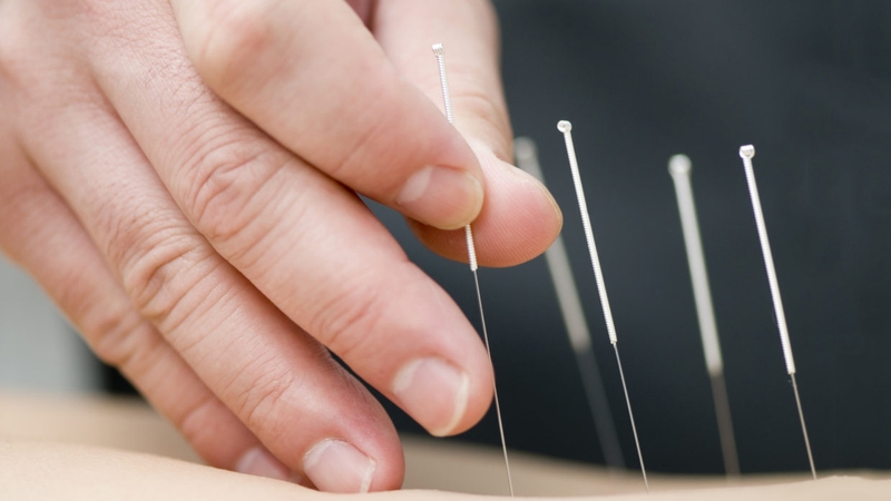 Giải đáp thắc mắc: Thoái hóa cột sống có châm cứu được không 2