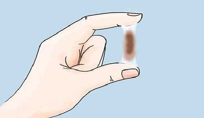 Giải đáp thắc mắc về tình trạng máu báo thai màu nâu nhạt 2