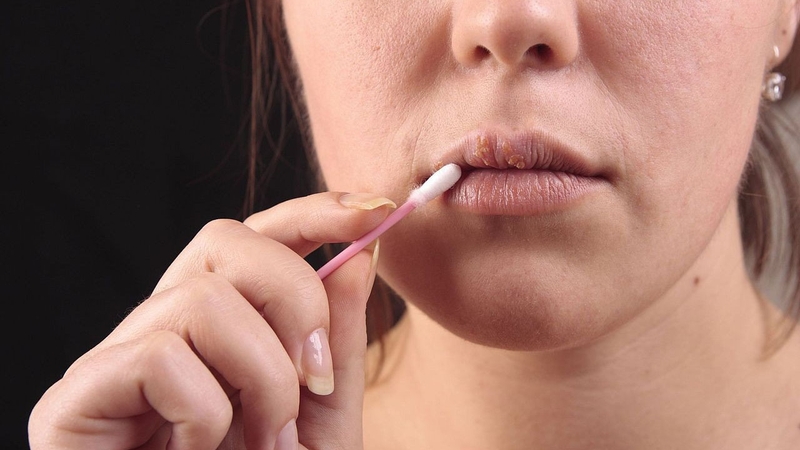 Giải đáp thắc mắc: Xăm môi ăn cá diêu hồng được không 3