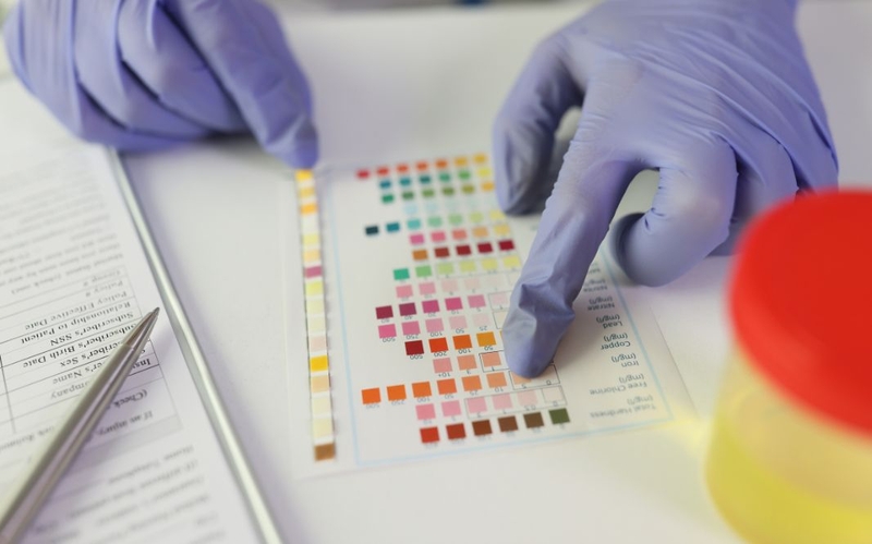 Glucose trong nước tiểu 500 có sao không? Cần làm gì để kiểm soát 1